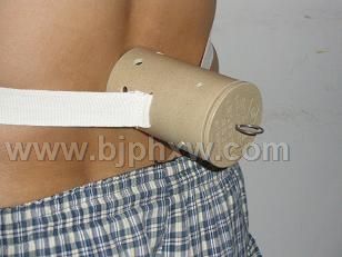 招代理溫灸器艾灸腰椎病