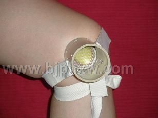 供應(yīng)灸療導(dǎo)入器艾灸關(guān)節(jié)痛